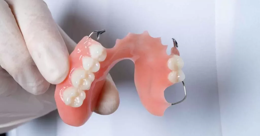 Partial Dentures