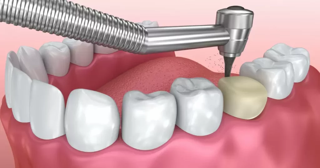 Procedure and Installation Process