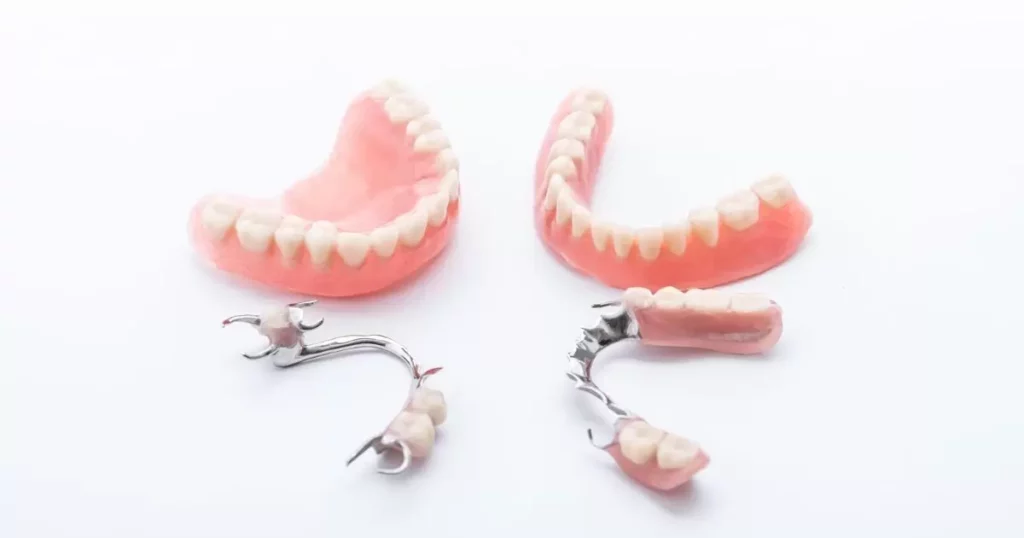 Understanding Partial Dentures