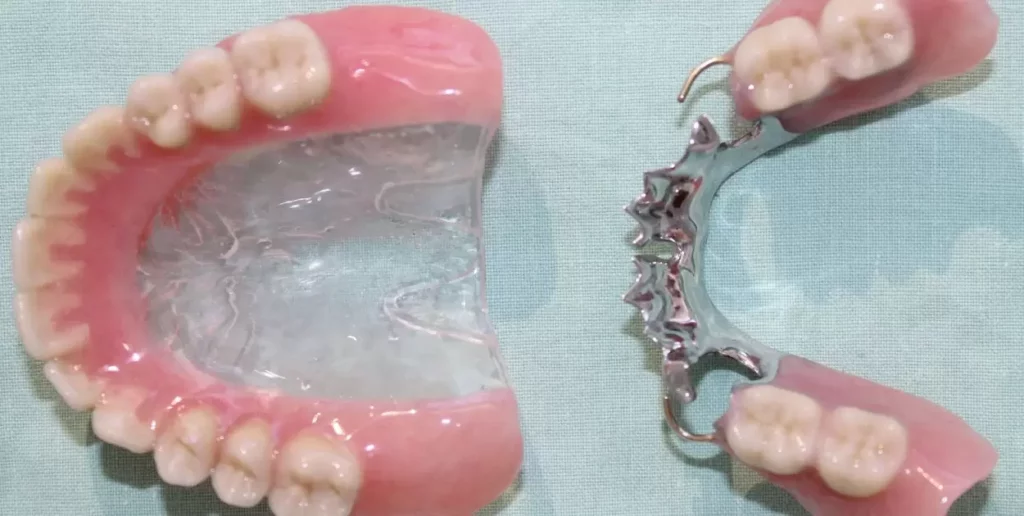 What Do Partial Dentures Look Like?