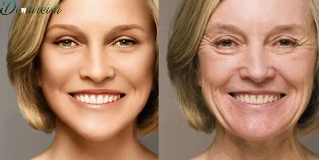 Before And After Pictures Of Dentures Wearers