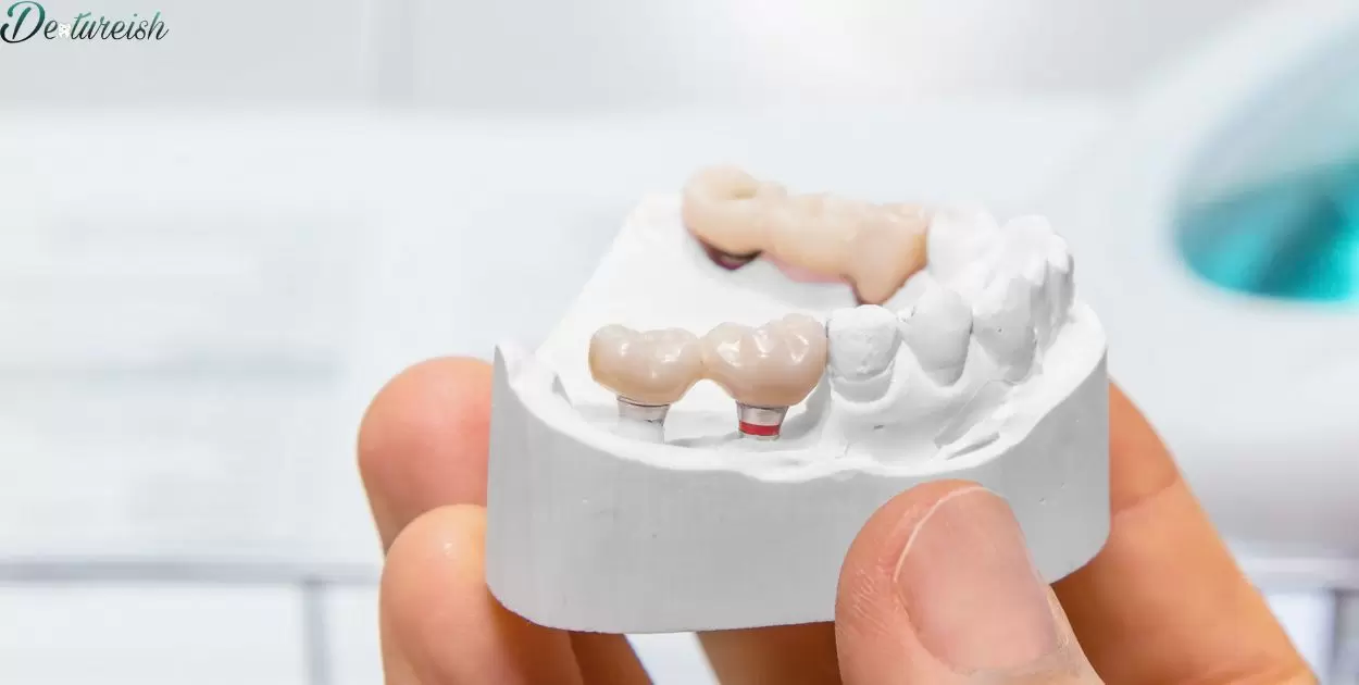 Can Denture Teeth Be Shortened?