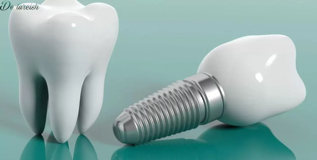 Can I Get Dental Implants If I Have Dentures?