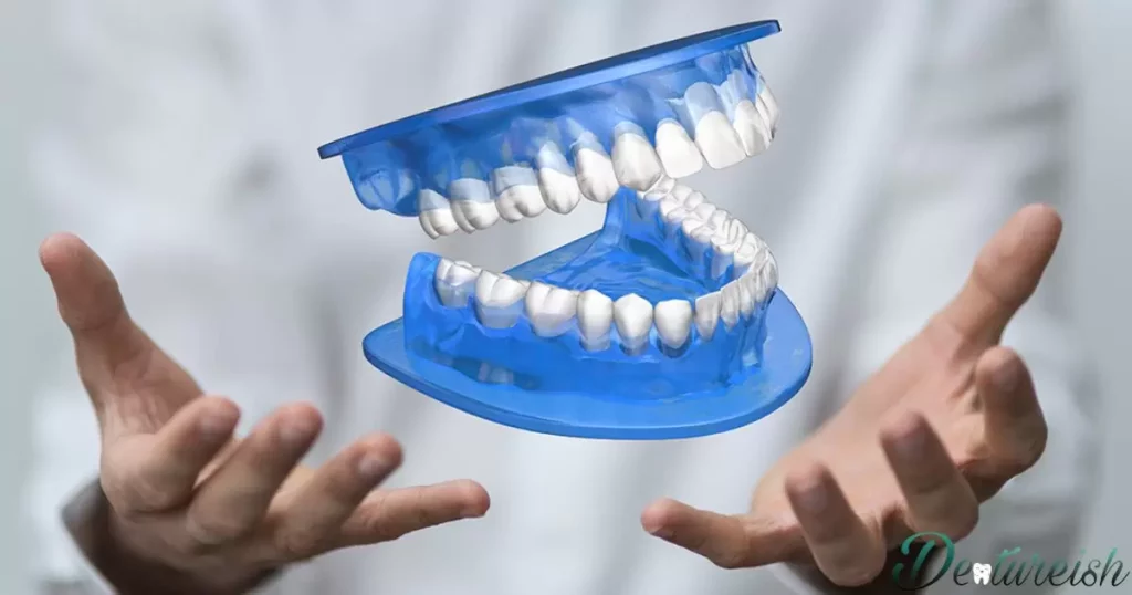 denture arch anatomy