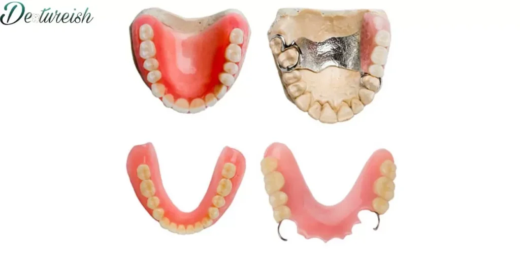 Denture Realignment and Replacement