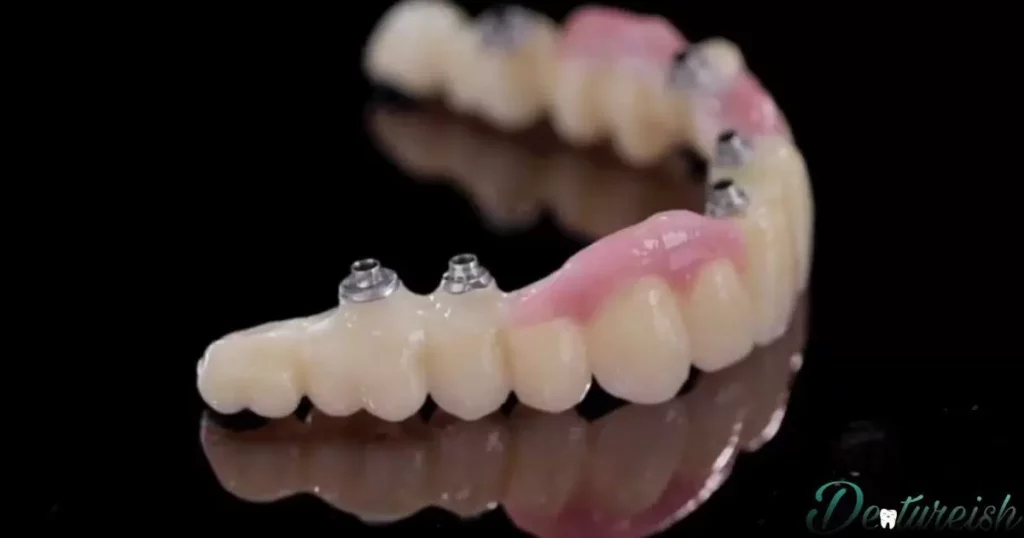 Future Trends in Denture Arch Development