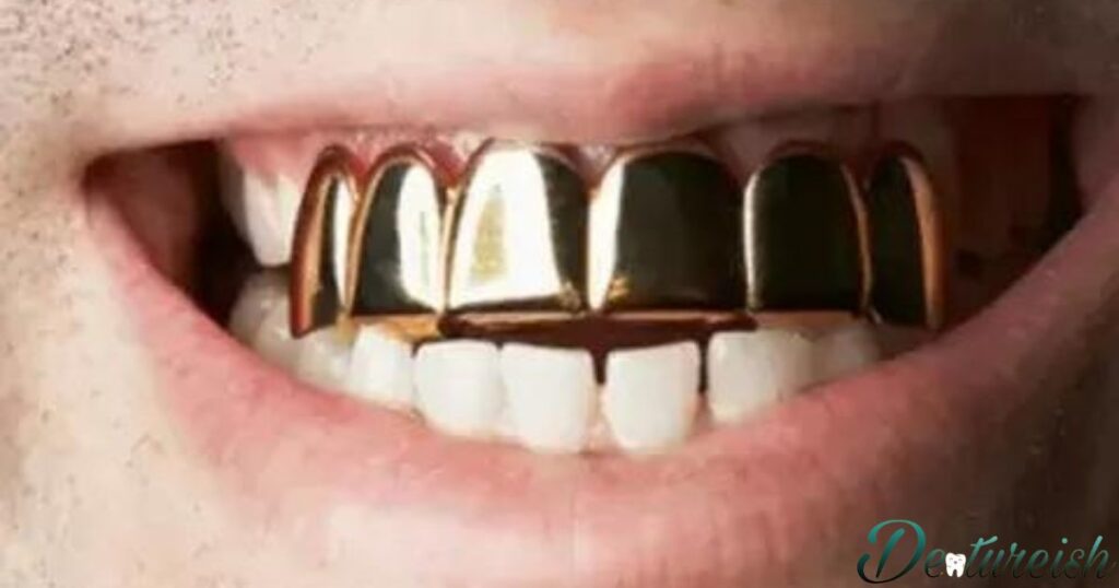 Gold Dentures Pictures