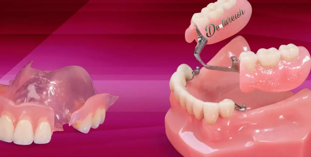 Partial Denture For One Tooth Cost