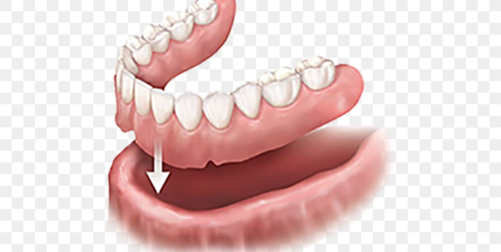 Technological Advancements in Arch Denture Design