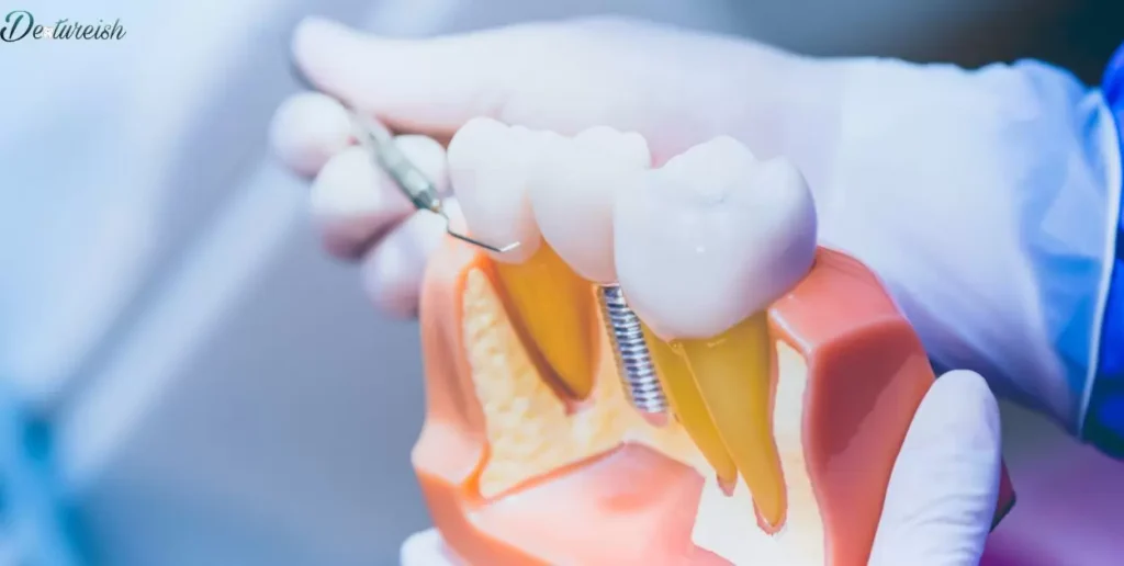 Denture Materials and Their Impact on Costs