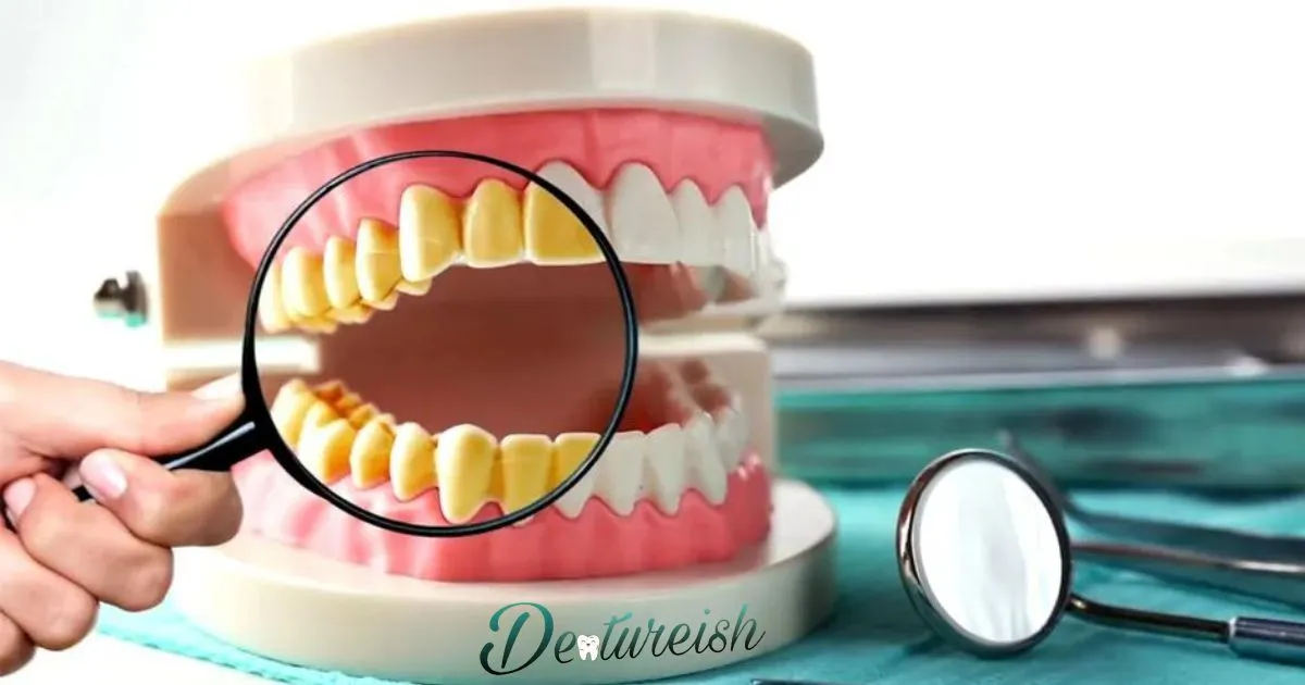 Clean Plaque Off Partial Dentures