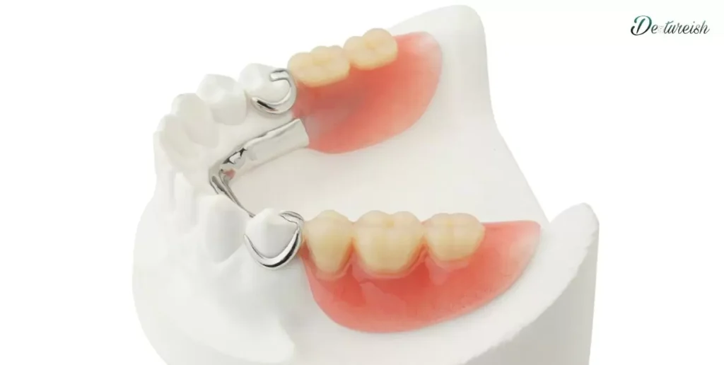 Partial Dentures For Back Teeth One Side