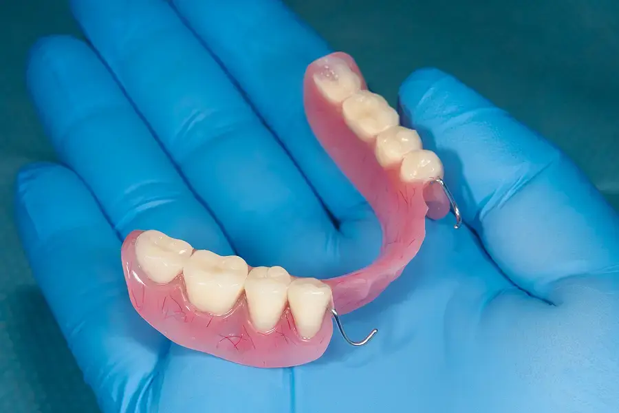 Removable Partial Denture For One Tooth