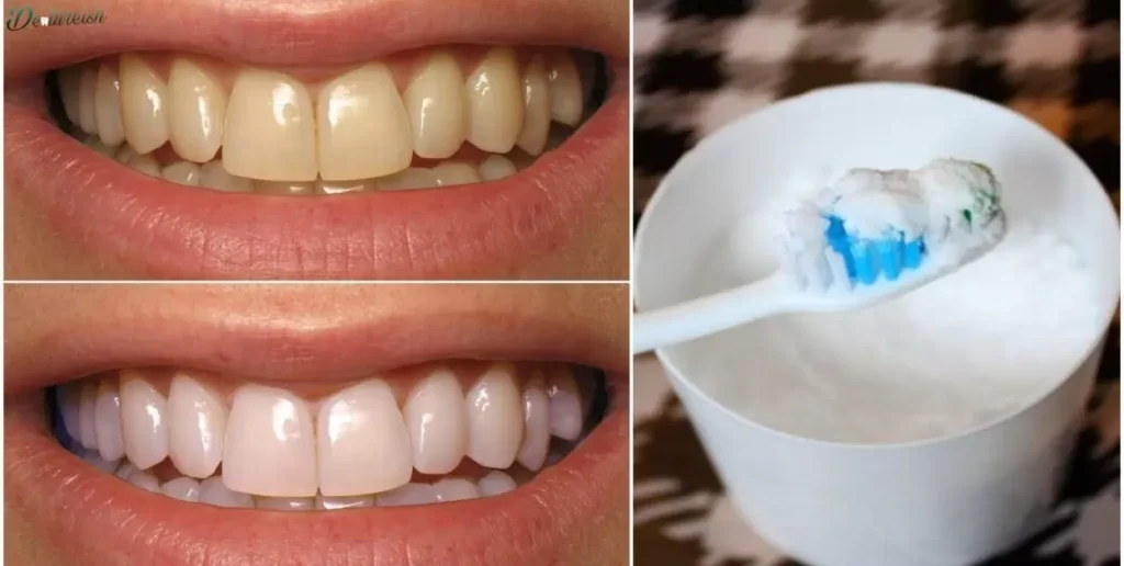 Will Baking Soda Remove Plaque From Dentures