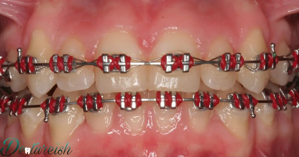 Braces Colours Red