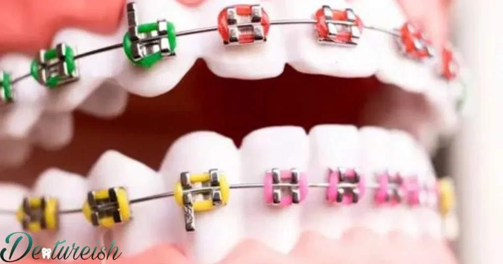 Red Revival: Embracing The Modern Orthodontic Palette