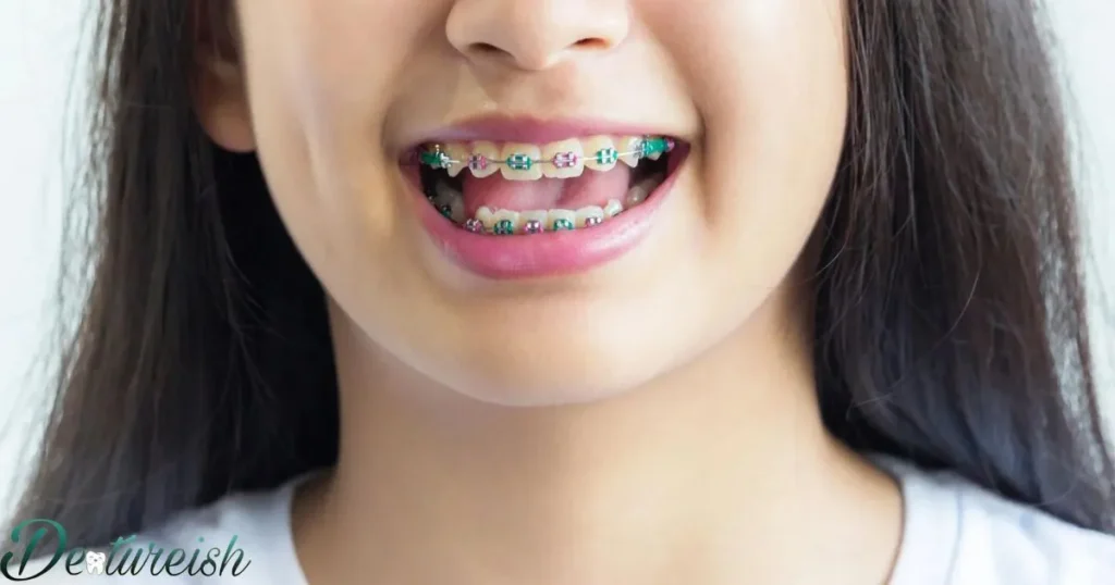 Braces Key Takeaway: Small Changes Lead To Big Straight Smiles